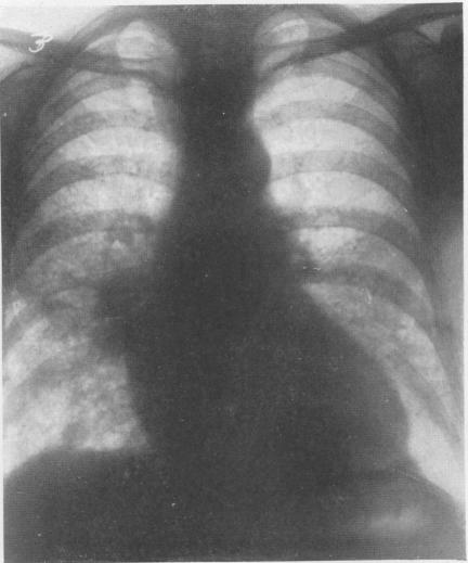 graphic file with name brjindmed00251-0067-a.jpg