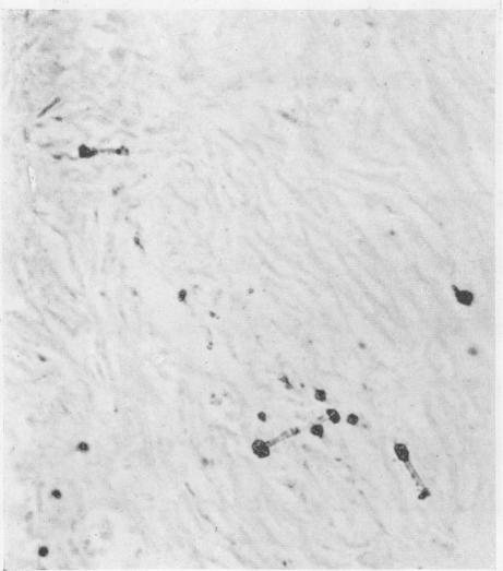 graphic file with name brjindmed00251-0068-d.jpg