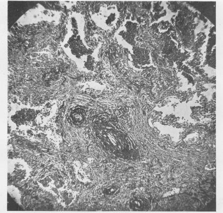 graphic file with name brjindmed00251-0069-a.jpg
