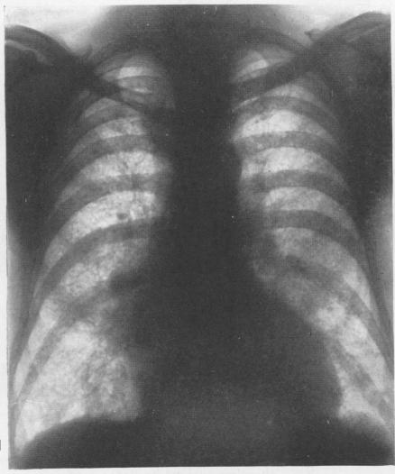 graphic file with name brjindmed00251-0067-b.jpg