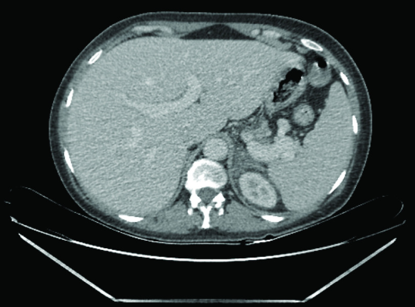 Figure 2. 