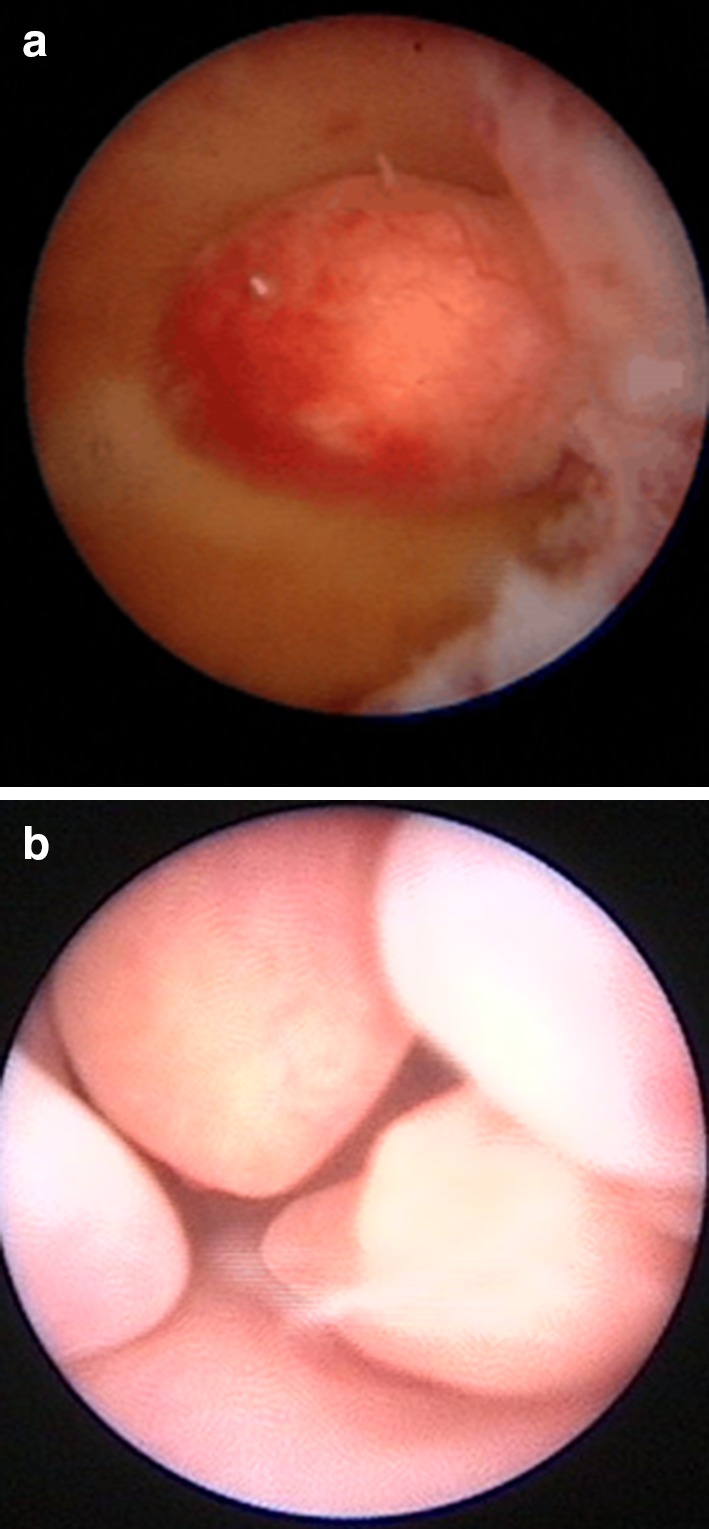 Fig. 3