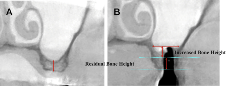 Fig. 2