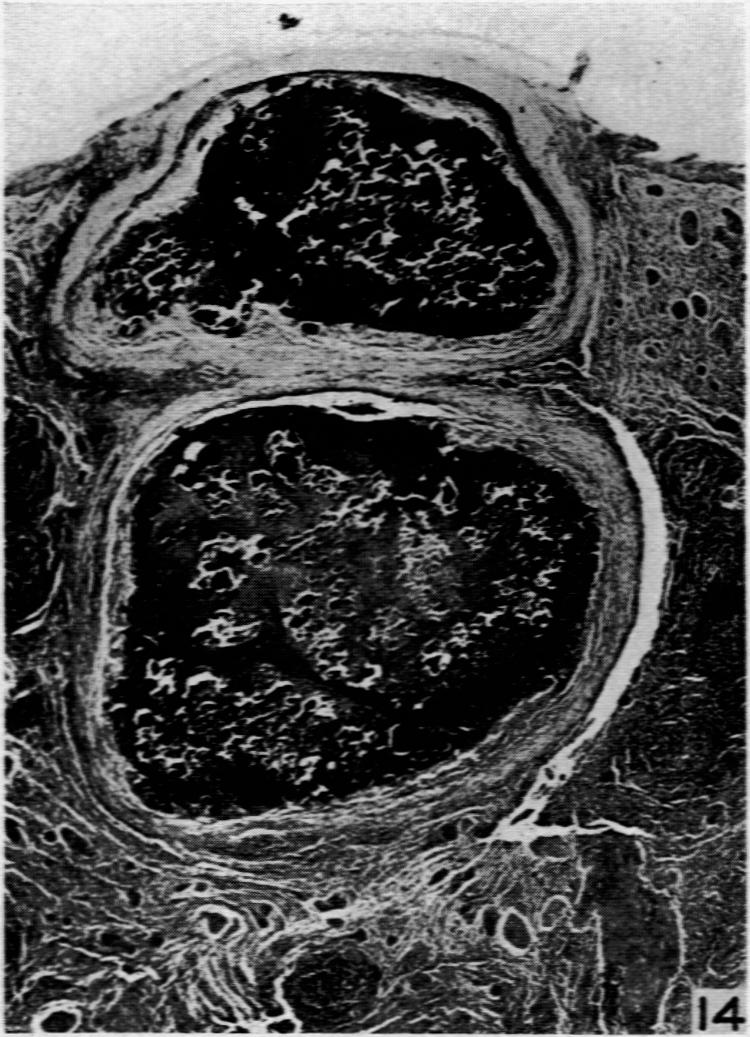 Fig. 14