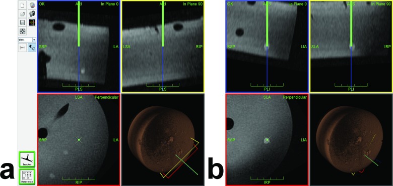 Fig 3