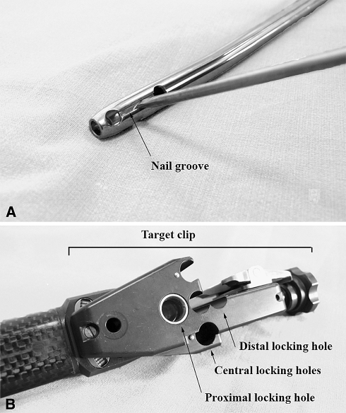 Fig. 1A–B