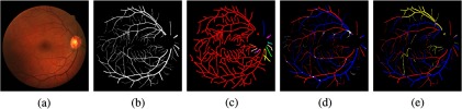 Fig. 13