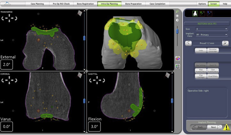 Fig 4