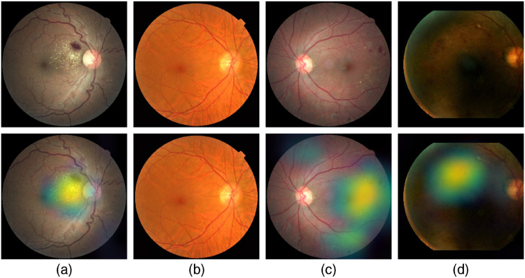 Fig. 18