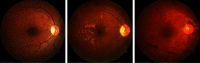 Fig. 11