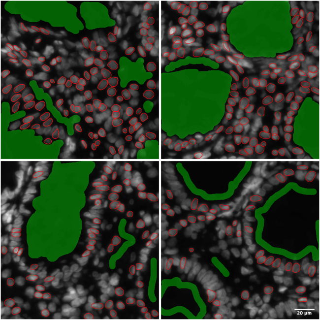 Figure 11