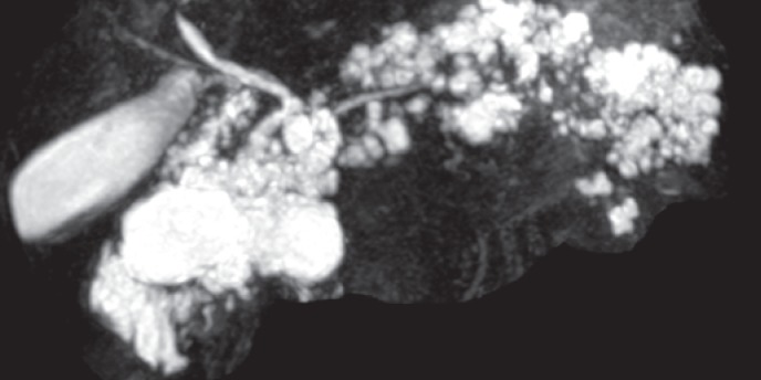Fig. 14