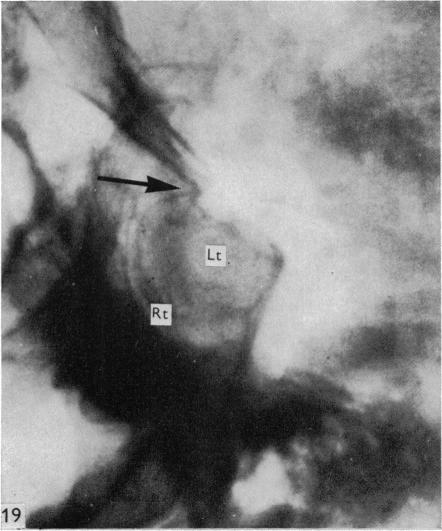 Fig. 19