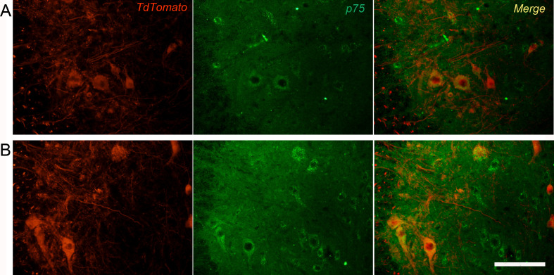 Figure 3—figure supplement 3.