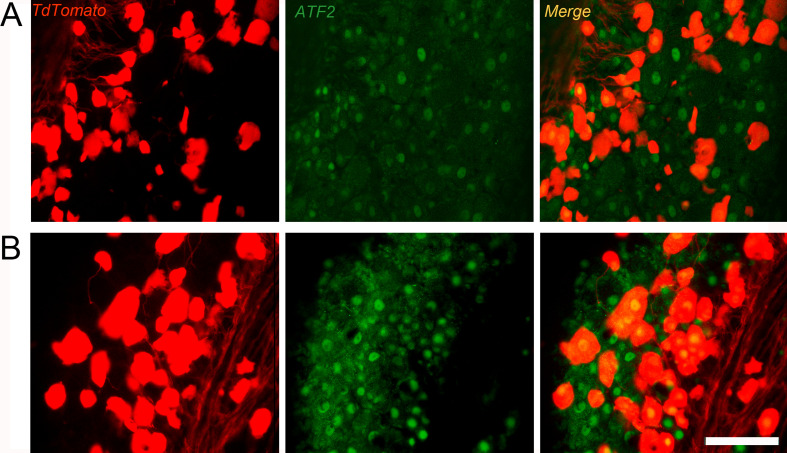 Figure 3—figure supplement 4.