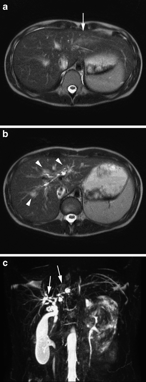 Fig. 15