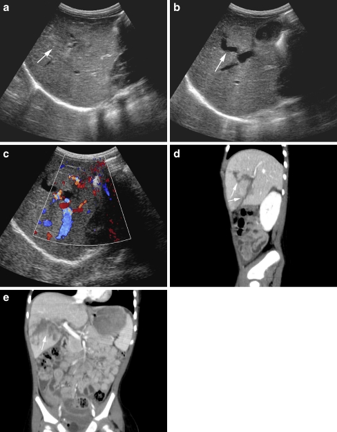 Fig. 22