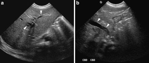 Fig. 13