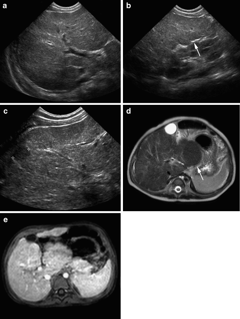 Fig. 16