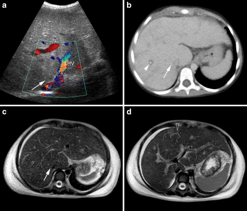 Fig. 19