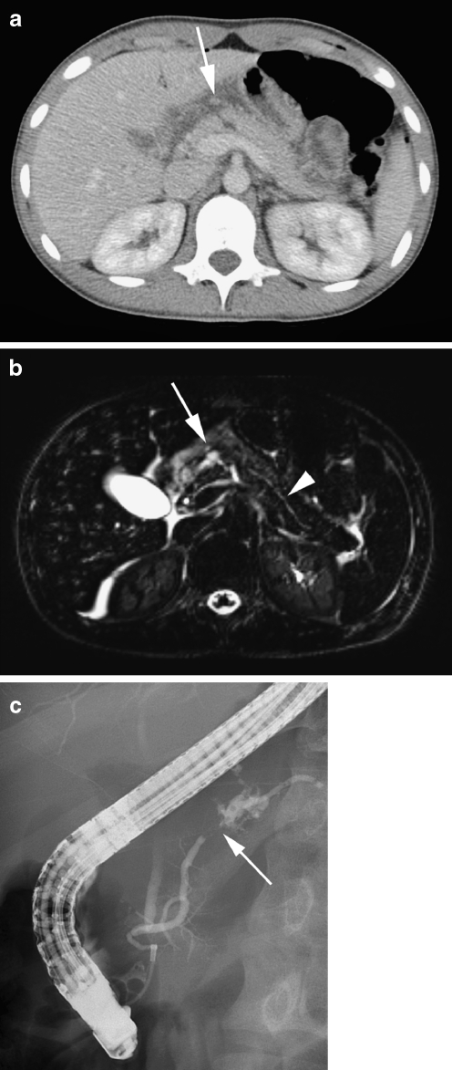 Fig. 24