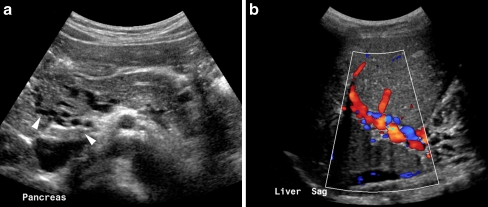 Fig. 18