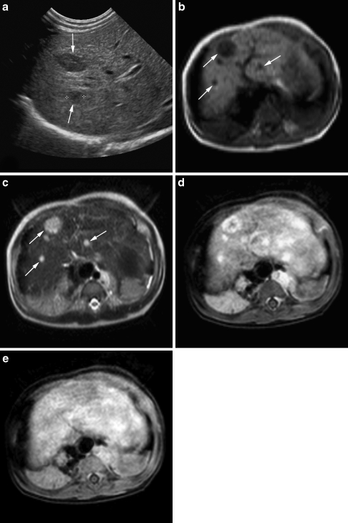 Fig. 11