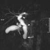 Fig. 14