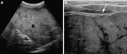 Fig. 10