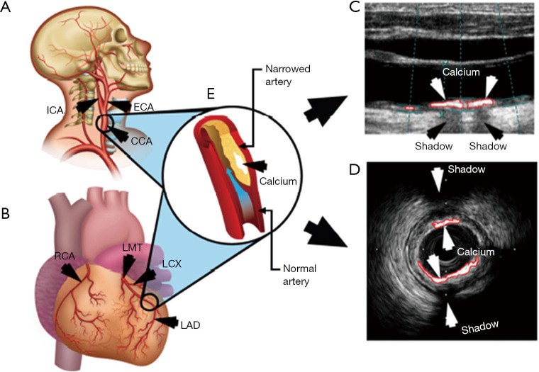 Figure 14