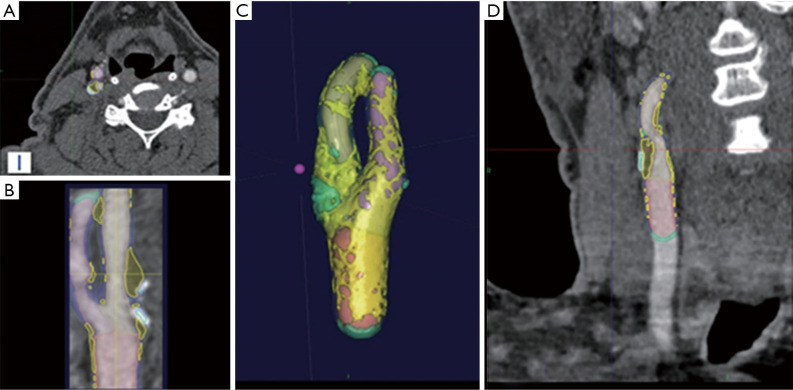 Figure 15