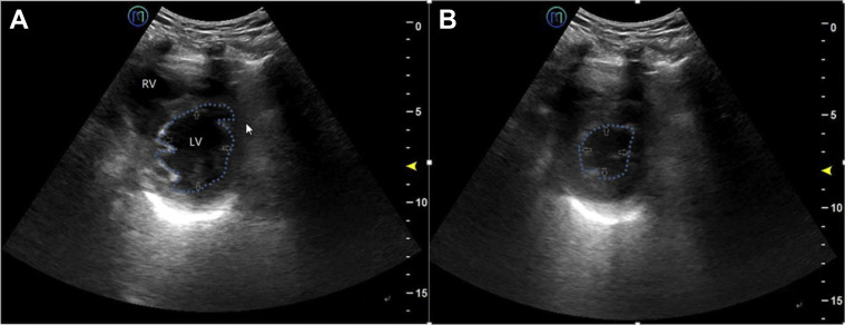 Figure 3