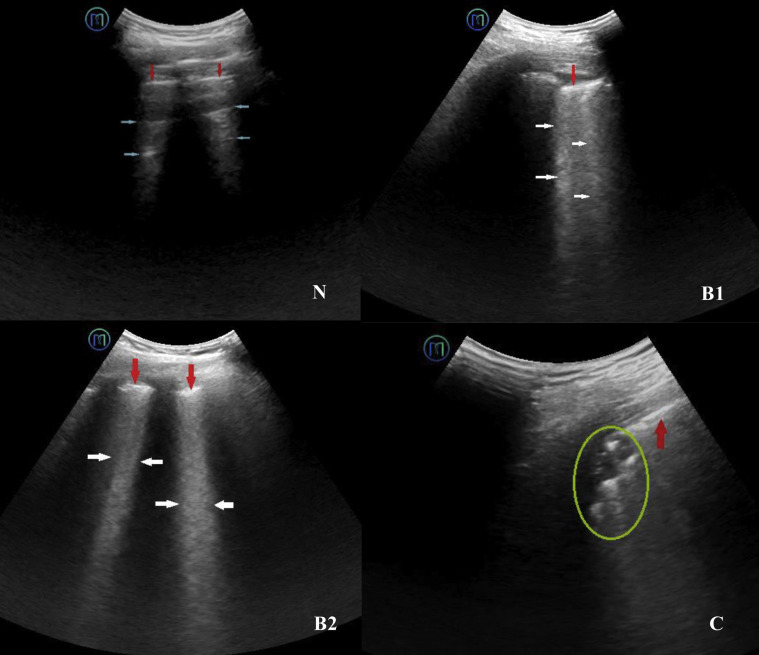 Figure 4