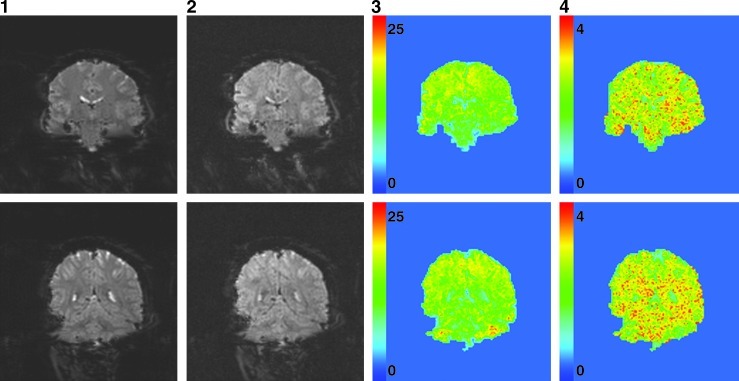 FIG. 4.