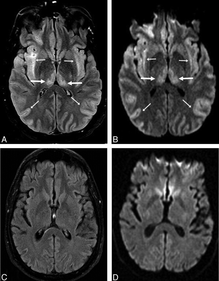 Fig 4.