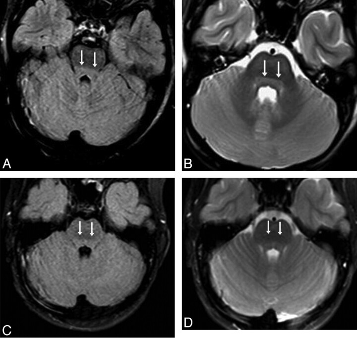 Fig 3.