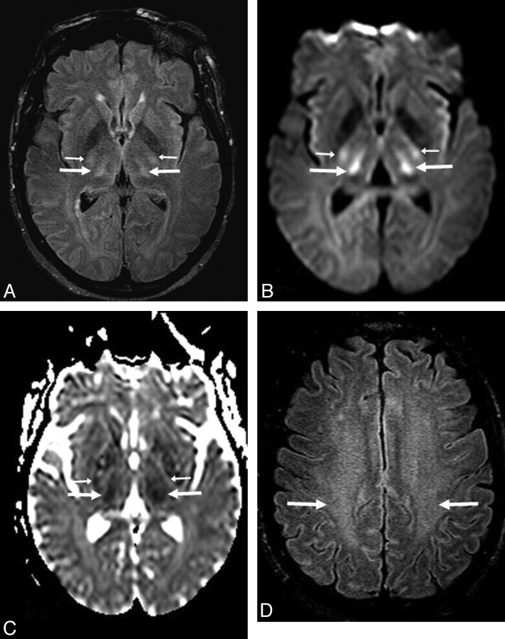 Fig 2.