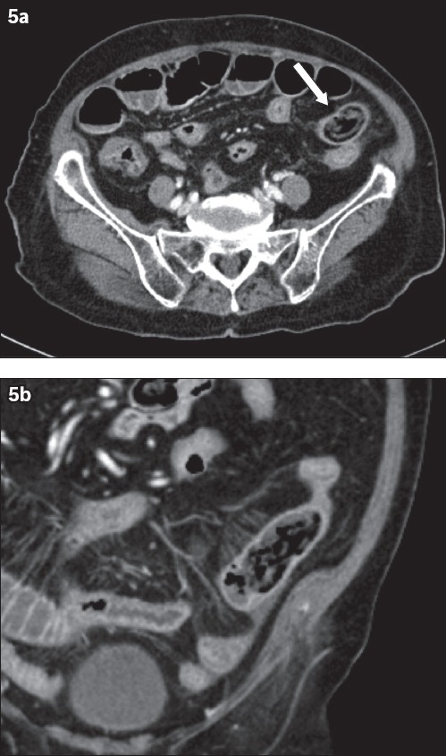 Fig. 5