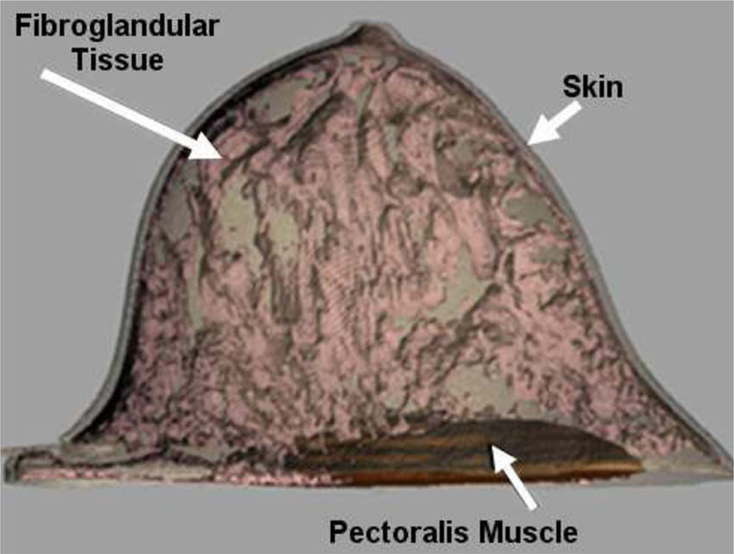 Fig. 15