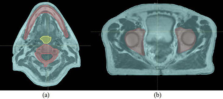 Fig. 5