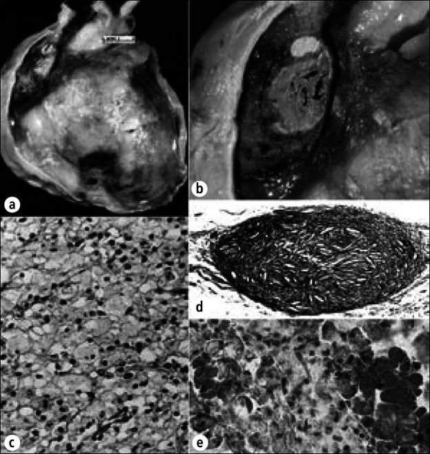 Figure 23