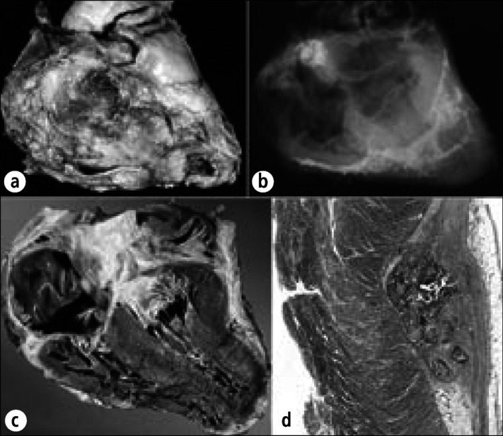 Figure 22