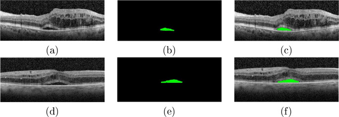 Fig. 12