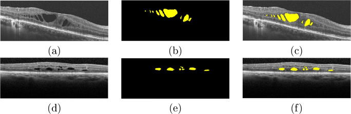 Fig. 13