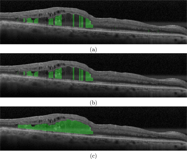 Fig. 14