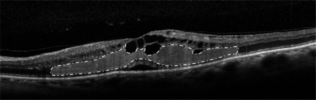 Fig. 10