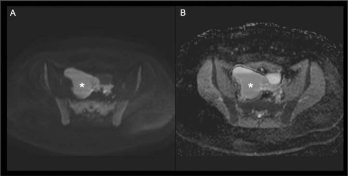Fig 2: