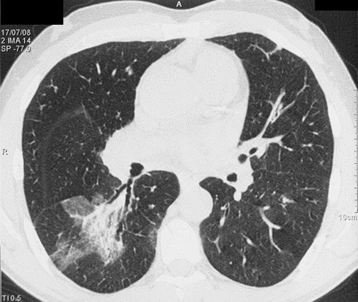 Fig. 15.6