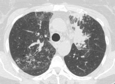 Fig. 15.8