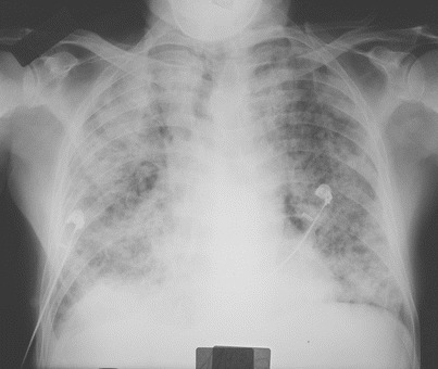 Fig. 15.3